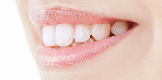 同時にホワイトニングで理想の歯並びへ